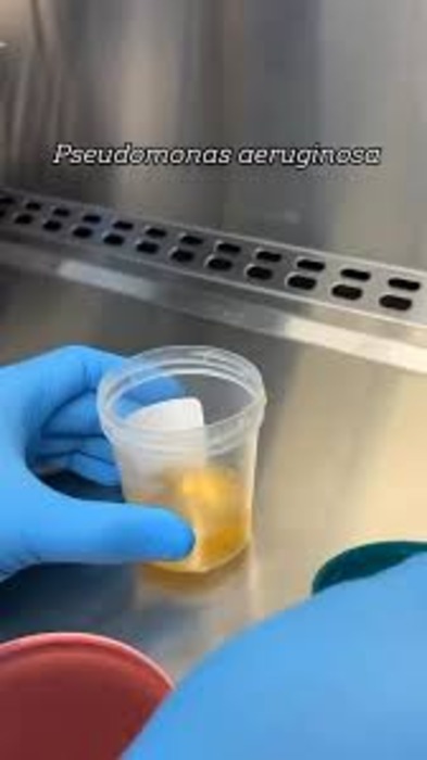 what permonidehidom used in